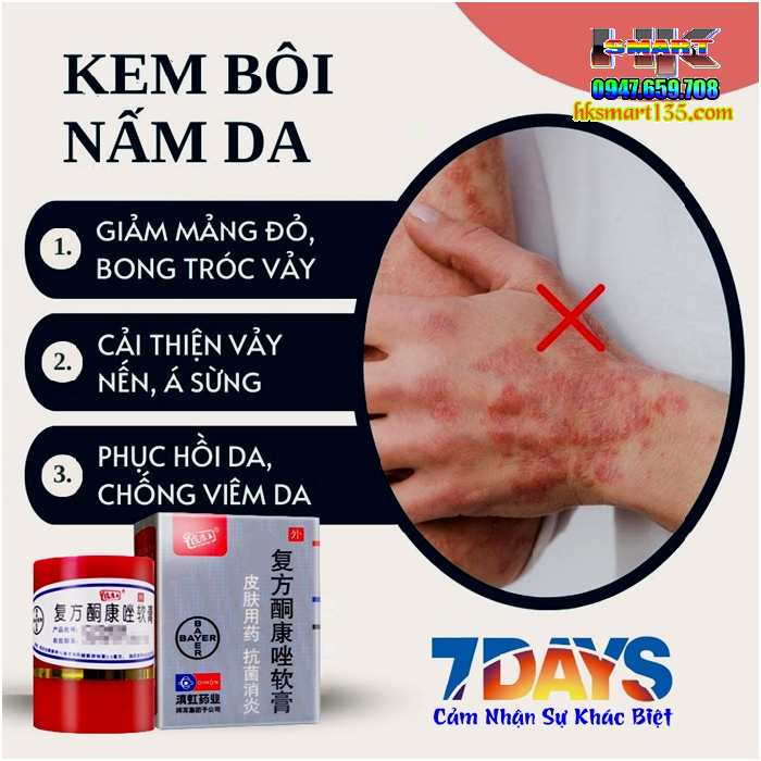 Kem Bôi Nội Địa Trung Hộp Đỏ 7gr- Đặc Trị Mọi Loại Nấm Ngứa Lang Ben