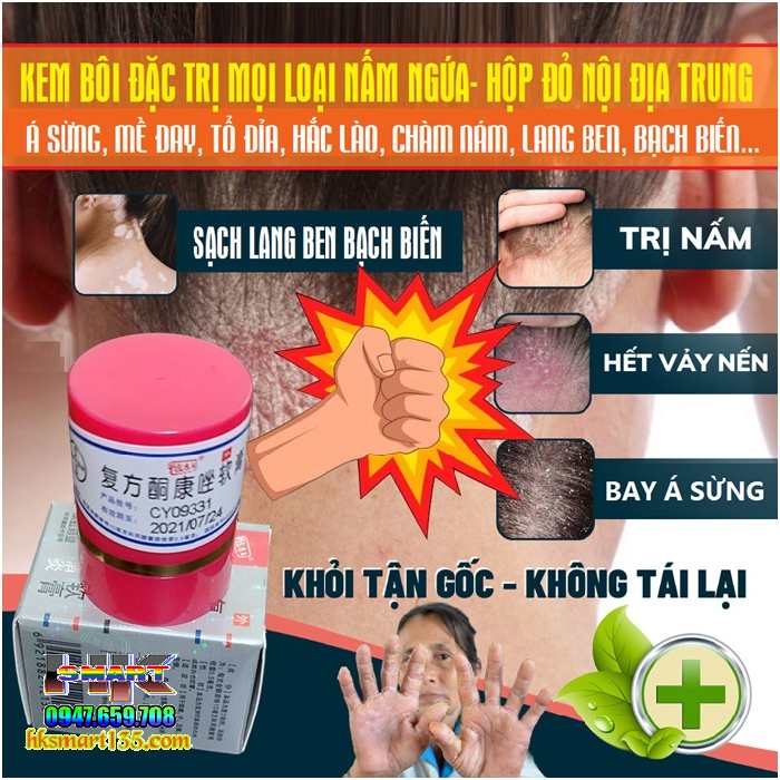 Kem Bôi Nội Địa Trung Hộp Đỏ 7gr- Đặc Trị Mọi Loại Nấm Ngứa Lang Ben