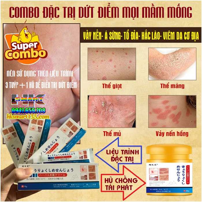 Combo Kem bôi đặc trị và ngừa tái phát nấm ngứa á sừng vảy nến Nhật Bản