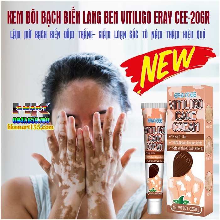 Kem bôi bạch biến lang ben Vitiligo ERAY CEE- 20gr làm mờ bạch biến đốm trắng