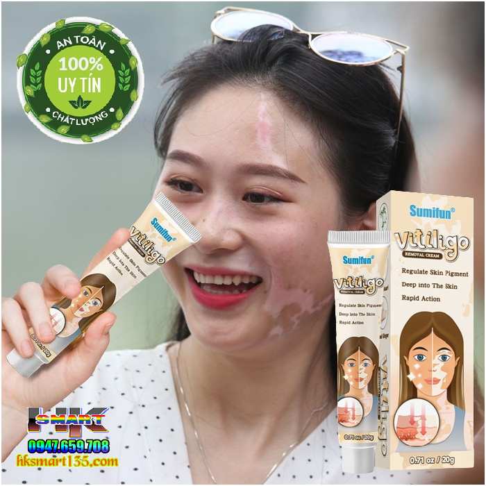 Kem bôi bạch biến lang ben Vitiligo - 20gr làm mờ bạch biến đốm trắng