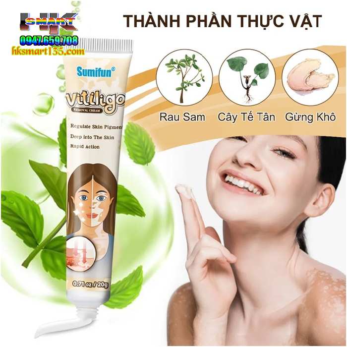 Kem bôi bạch biến lang ben Vitiligo - 20gr làm mờ bạch biến đốm trắng