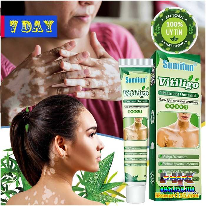 Kem bôi bạch biến lang ben Vitiligo - 20gr làm mờ bạch biến đốm trắng