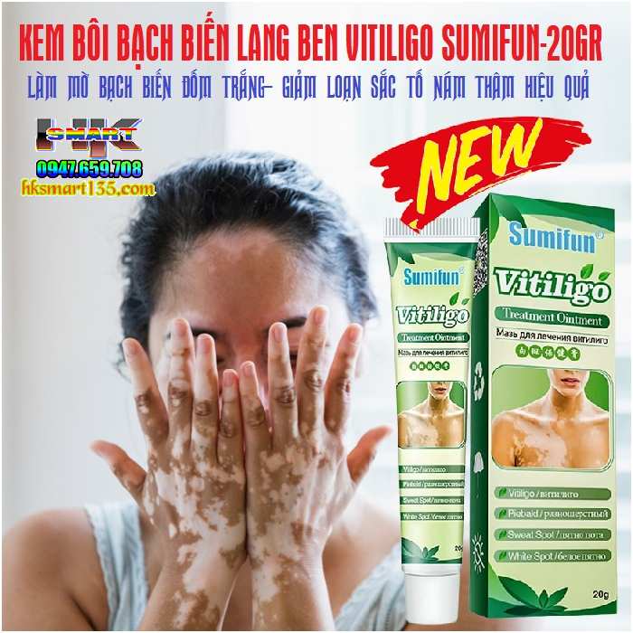 Kem bôi bạch biến lang ben Vitiligo - 20gr làm mờ bạch biến đốm trắng