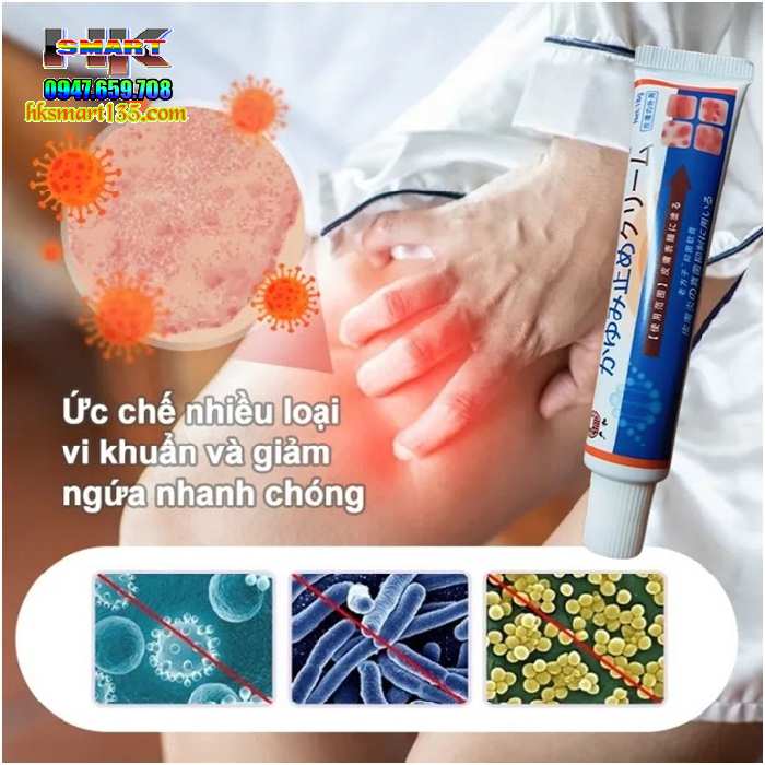 Kem bôi đặc trị viêm da cơ địa á sừng vảy nến nội địa Nhật Bản