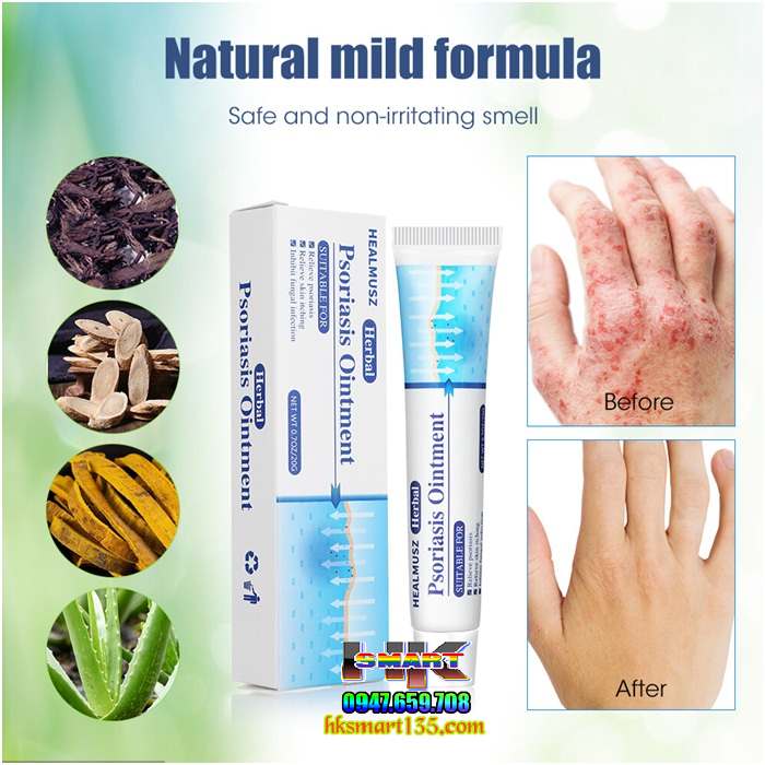 Kem bôi vảy nến HEALMUSZ Psoriasis Ointment xuất Mỹ