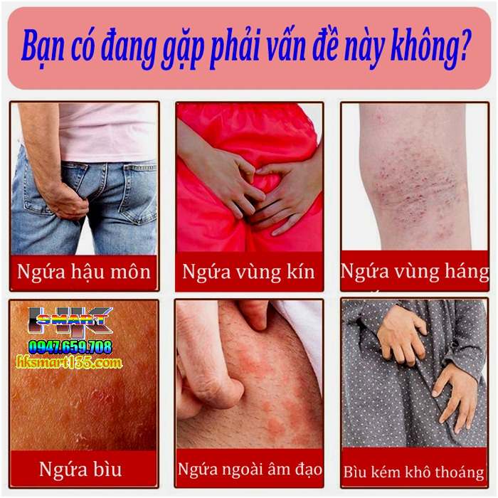 Kem bôi trị ngứa vùng kín nam giới