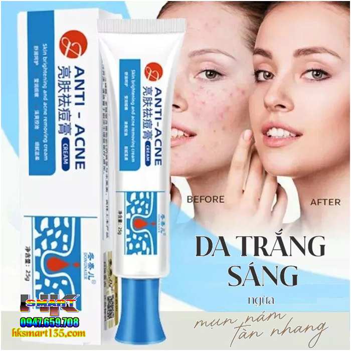 Kem Chấm Mụn Cấp Tốc Dongnaier 25gr- Loại Bỏ Nhanh Chóng Các Loại Mụn