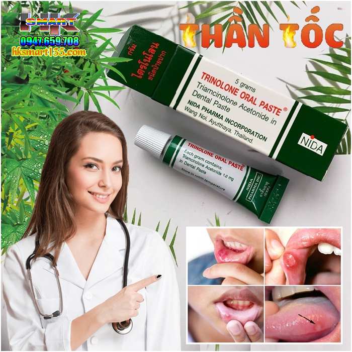 Kem Thoa Nhiệt Miệng Trinolone Oral Paste- Nida Thái Lan
