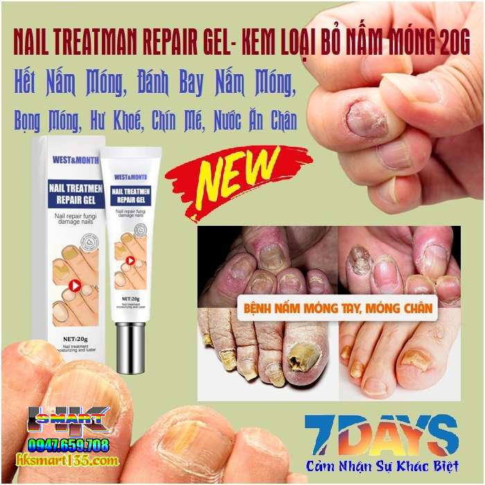 Repair Nail Treatment 20g- Kem Trị Nấm Móng Tay Chân