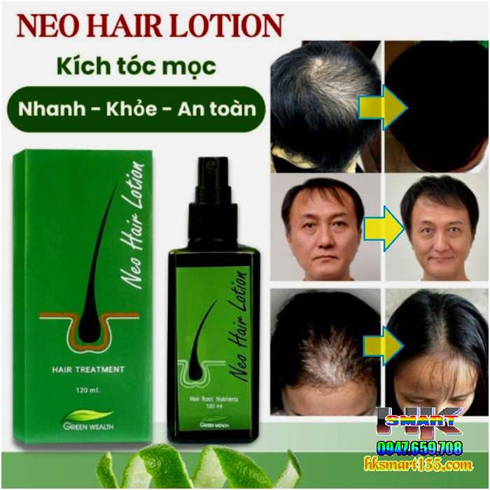  Thuốc xịt mọc tóc Neo Hair Lotion 120ml