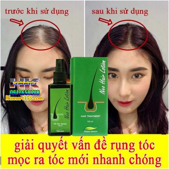  Thuốc xịt mọc tóc Neo Hair Lotion 120ml