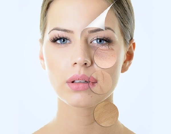 Xóa mờ nếp nhăn bằng công nghệ RF