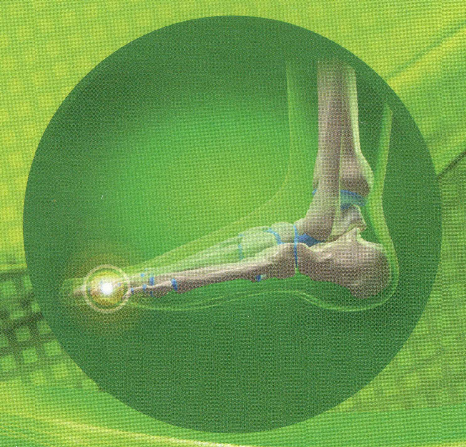 Nguyên nhân bệnh Gout. Cách phòng ngừa và điều trị. Nguyên nhân bệnh Gout. Cách phòng ngừa và điều trị.