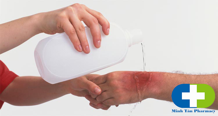 Bị bỏng nên làm gì Bị bỏng nên làm gì