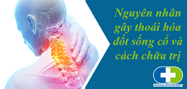 Thống kê nguyên nhân chính bị thoái hóa đốt sống cổ Thống kê nguyên nhân chính bị thoái hóa đốt sống cổ
