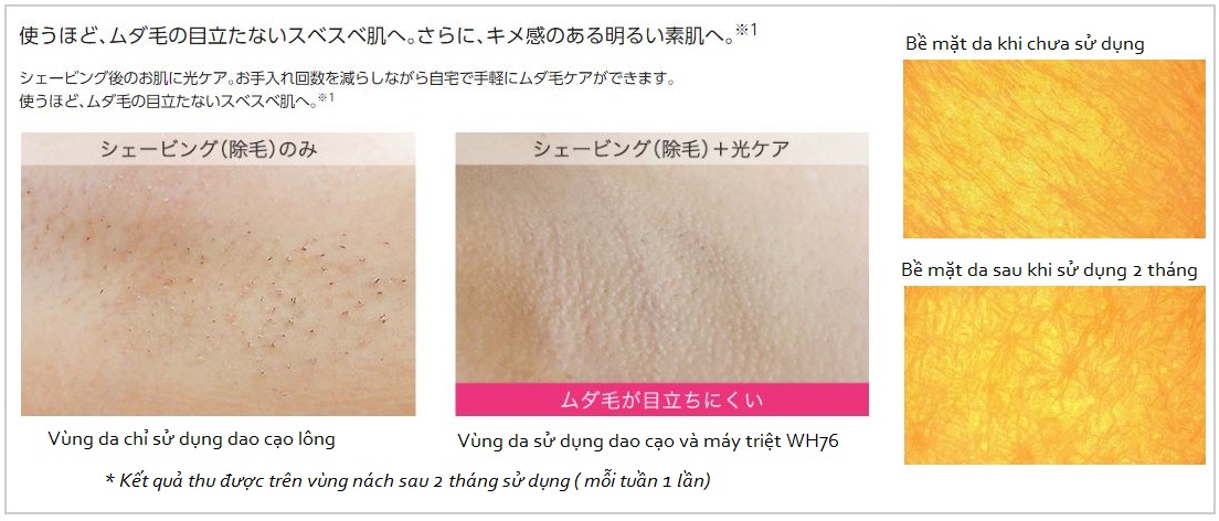 Máy triệt lông panasonic wh96