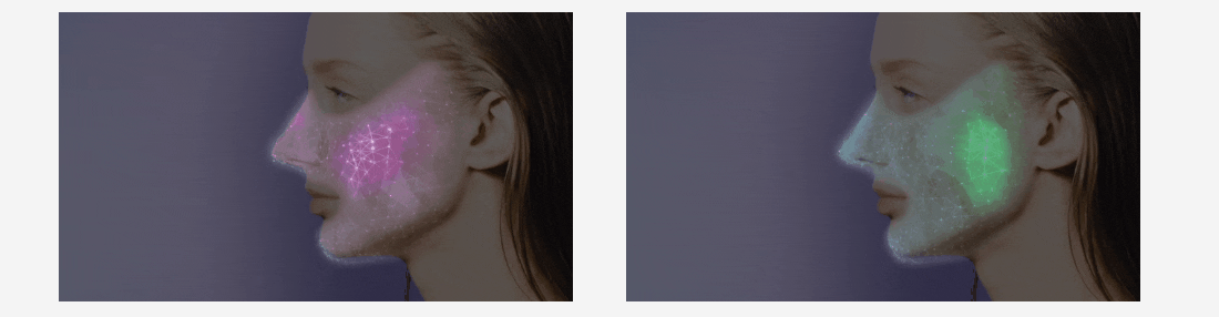 mặt nạ nâng cơ yaman medilift ep14bb