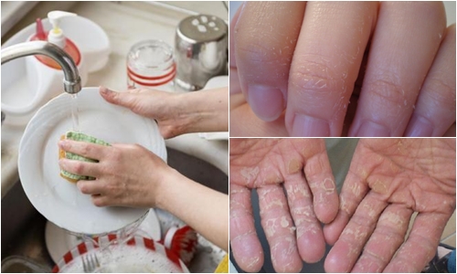 Nỗi sợ rửa bát mùa đông