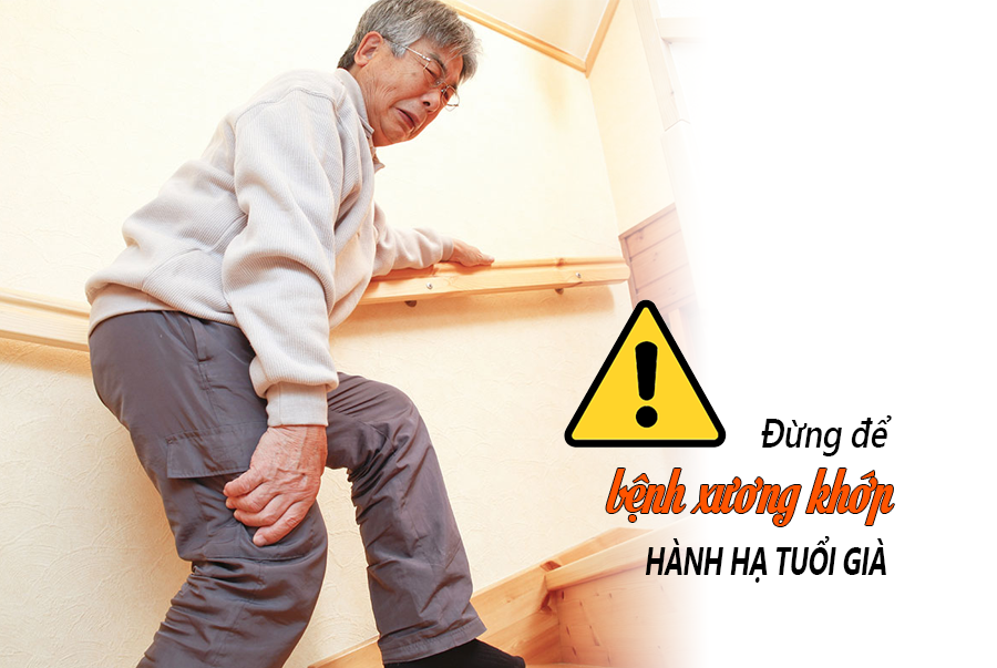 ĐỪNG CHỦ QUAN NẾU KHỚP XƯƠNG KÊU RĂNG RẮC HOẶC KHÓ CỬ ĐỘNG. ĐÂY LÀ DẤU HIỆU CỦA BỆNH CÓ THỂ GÂY BIẾN CHỨNG NGUY HIỂM, THẬM CHÍ LÀ TỬ VONG.