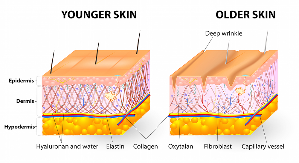 Collagen giúp săn chắc làn da
