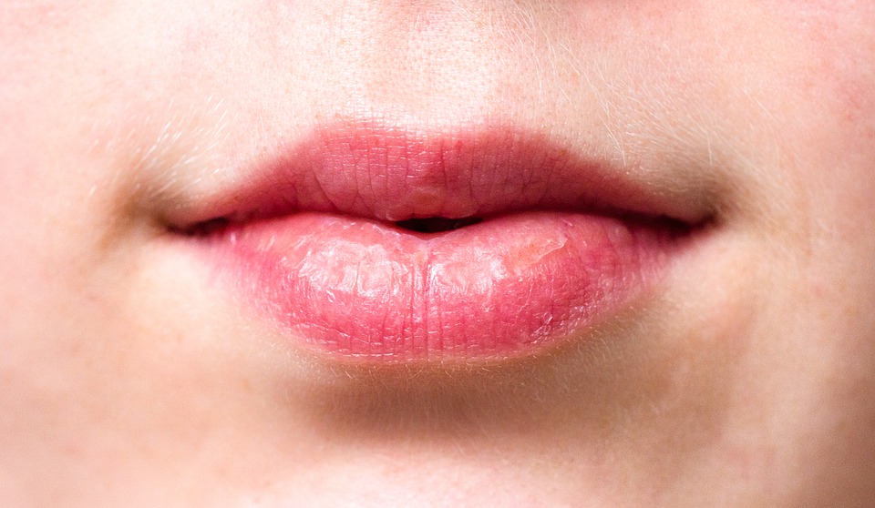 MỘT SỐ GỢI Ý ĐỐI PHÓ VỚI CHỨNG KHÔ MIỆNG VÀ LỞ LOÉT MIỆNG Ở BỆNH NHÂN UNG THƯ