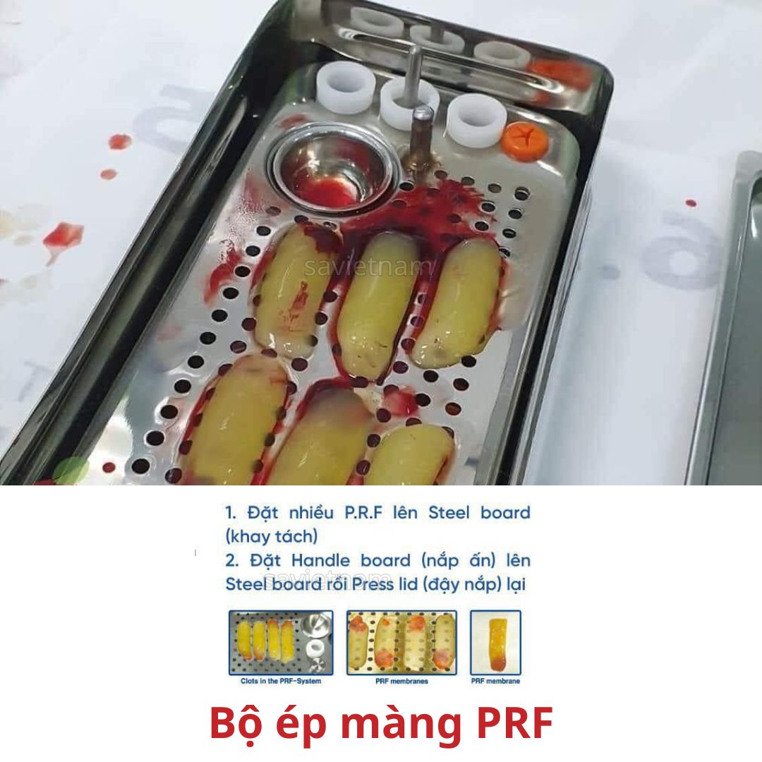 Bộ dụng cụ ép màng PRF (Platelet Rich Fibrin)