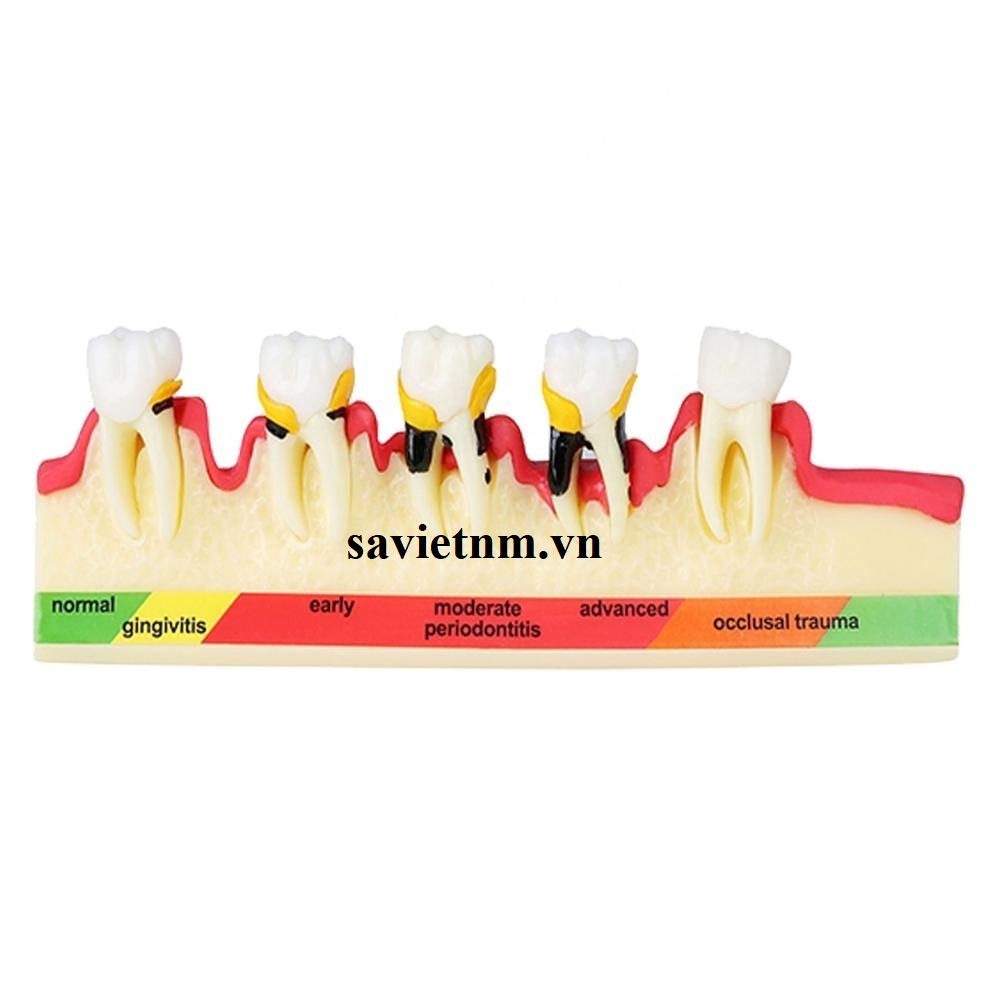 Hàm tư vấn bệnh lý nha khoa