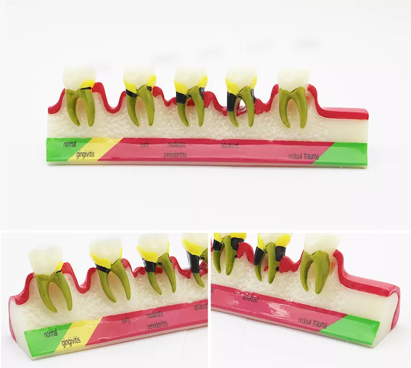 Hàm tư vấn bệnh lý nha khoa