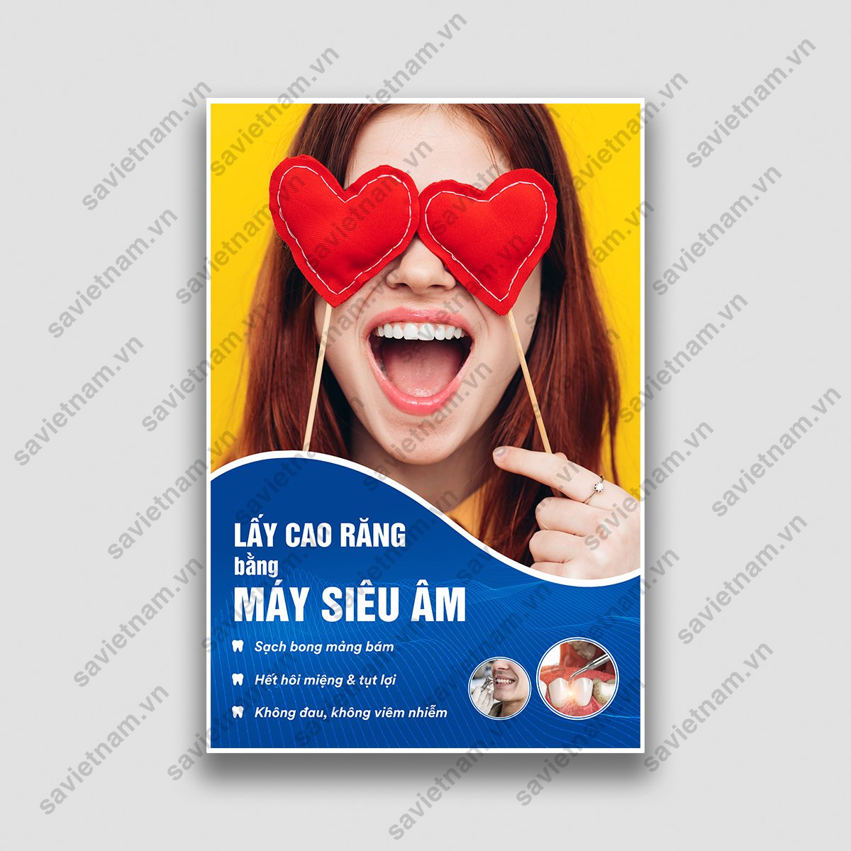 Tranh nha khoa Lấy cao răng bằng máy siêu âm