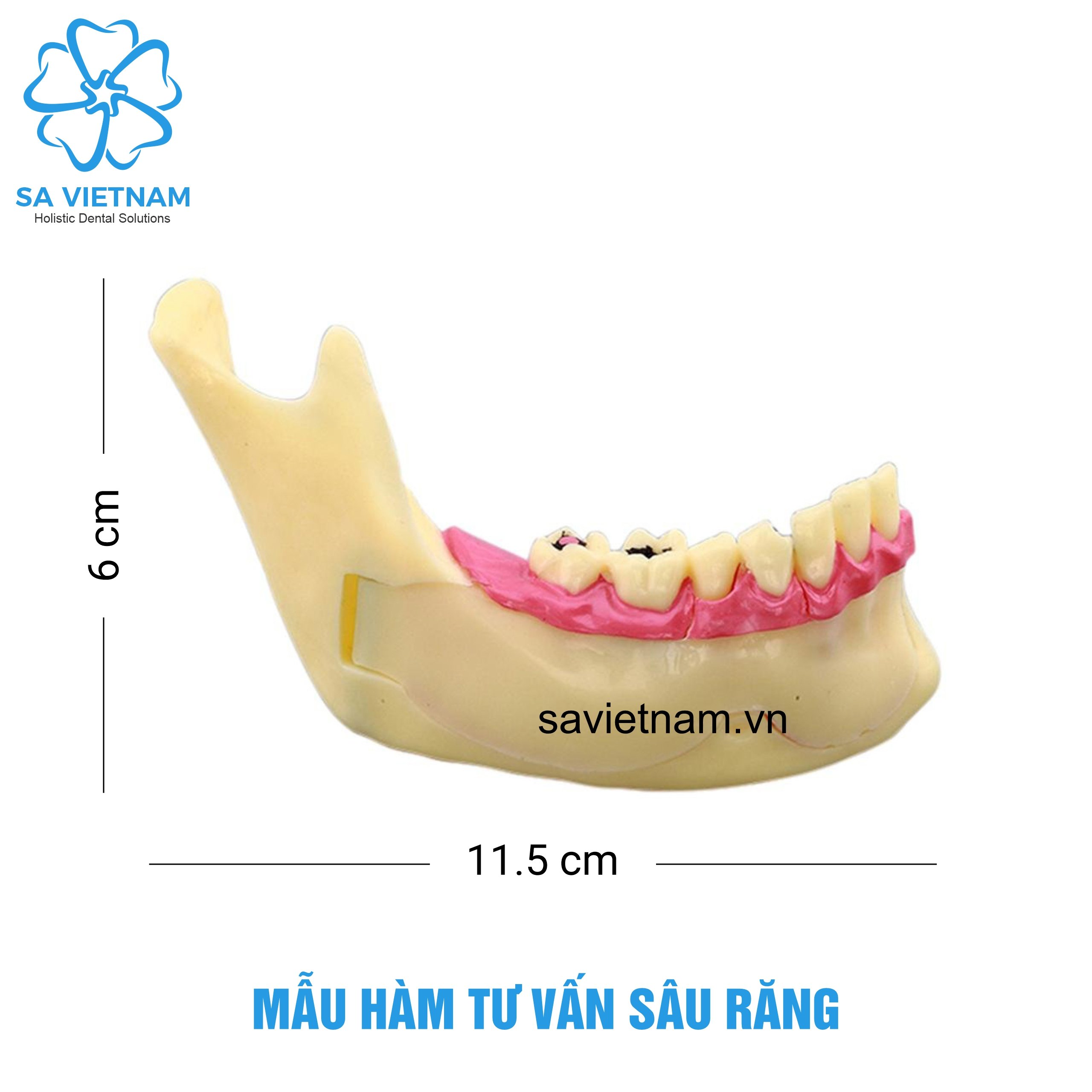 Mẫu hàm tư vấn sâu răng trong Nha khoa
