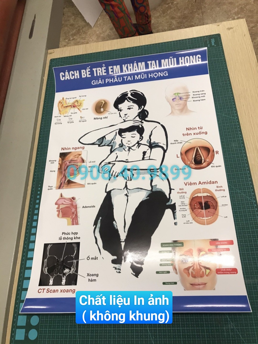 Tranh Cách bế trẻ em khám tai mũi họng (giải phẫu tai mũi họng) chất liệu mica