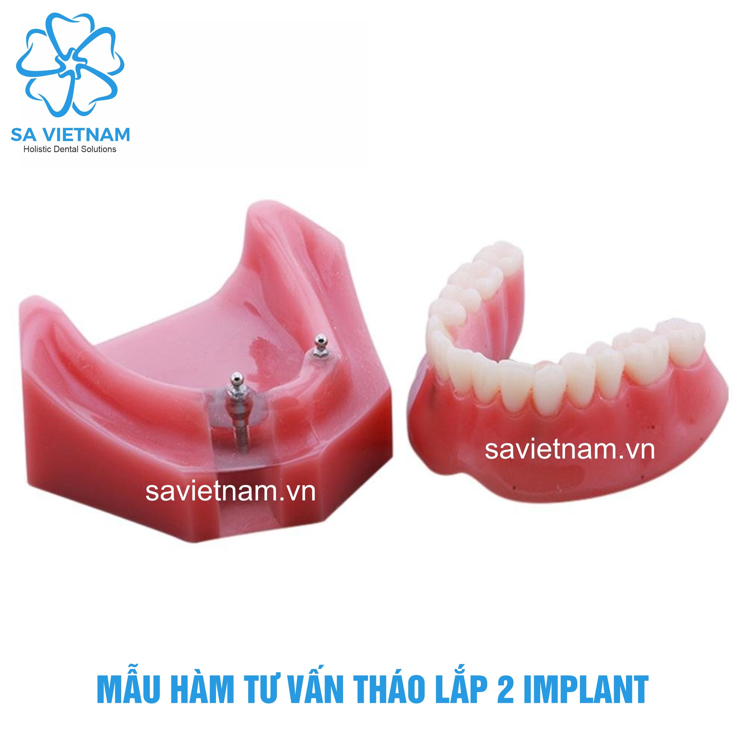 hàm tư vấn tháo lắp 2 implant