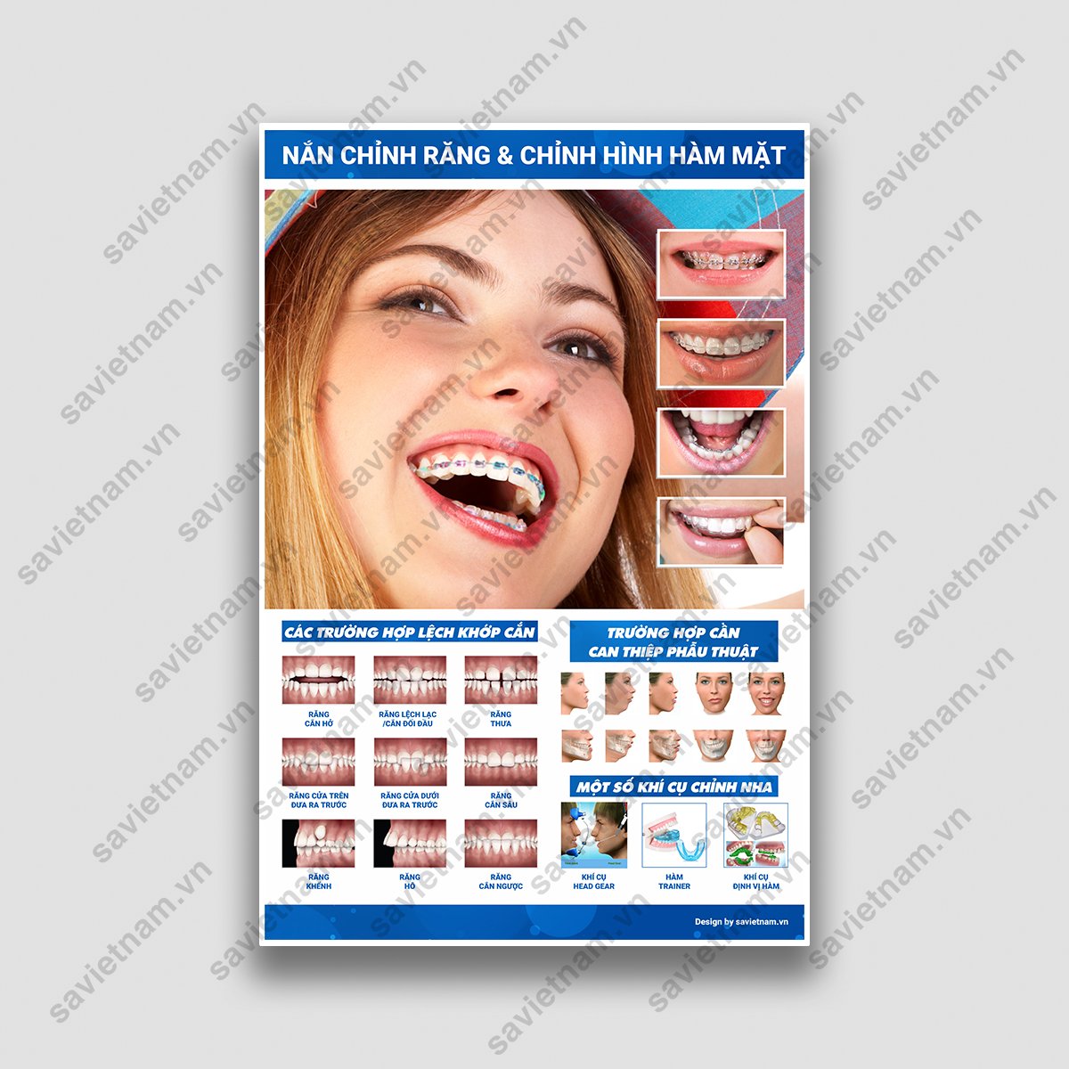 tranh chỉnh nha, tranh nắn chỉnh răng và chỉnh hình hàm mặt