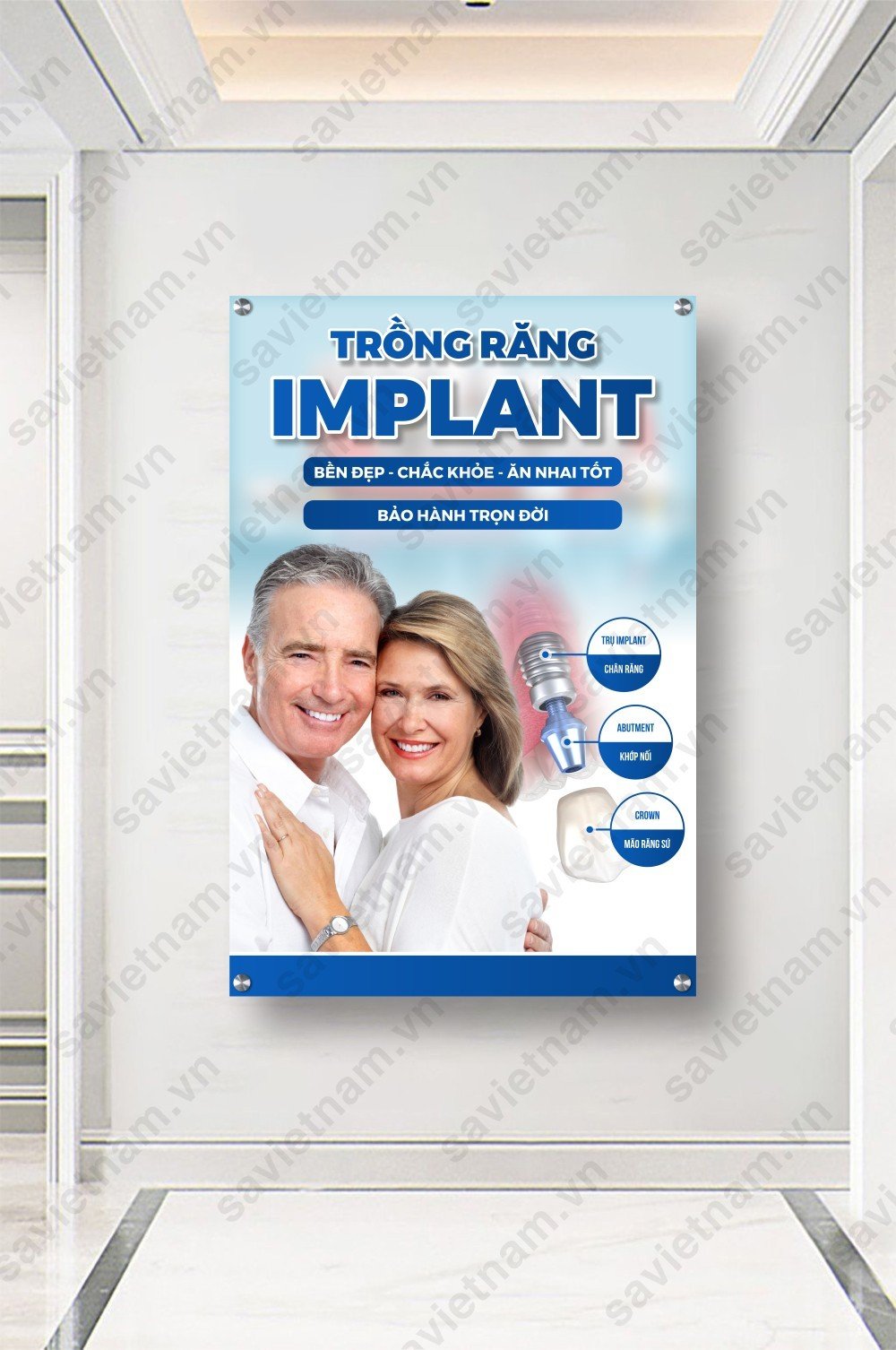 Tranh implant nha khoa