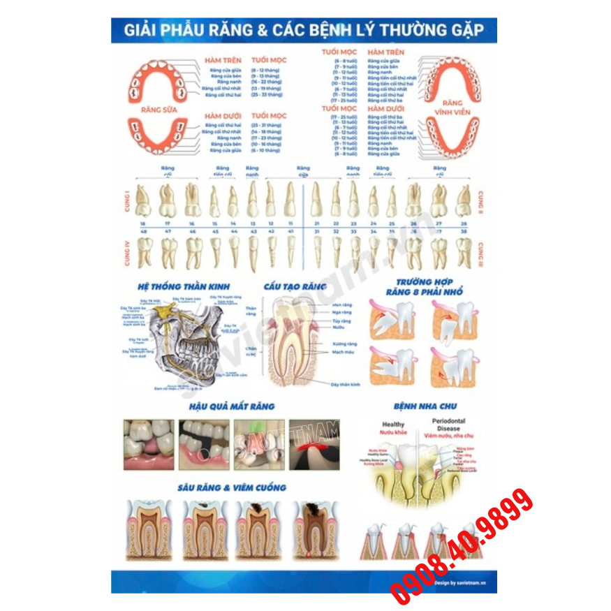 Tranh Giải phẫu các bệnh lý thường gặp