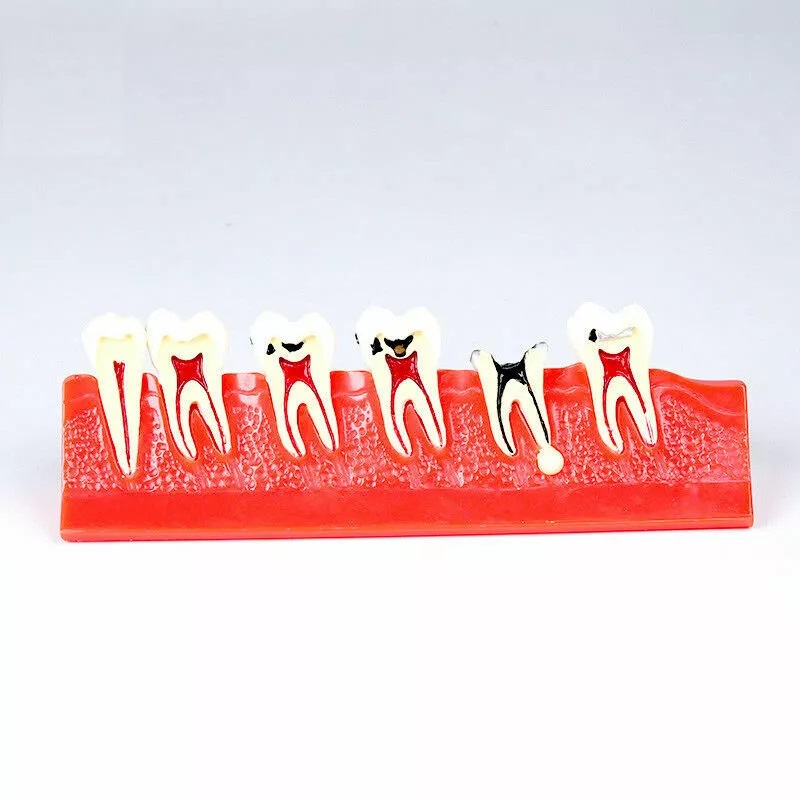 mẫu hàm tư vấn bệnh lý nha khoa