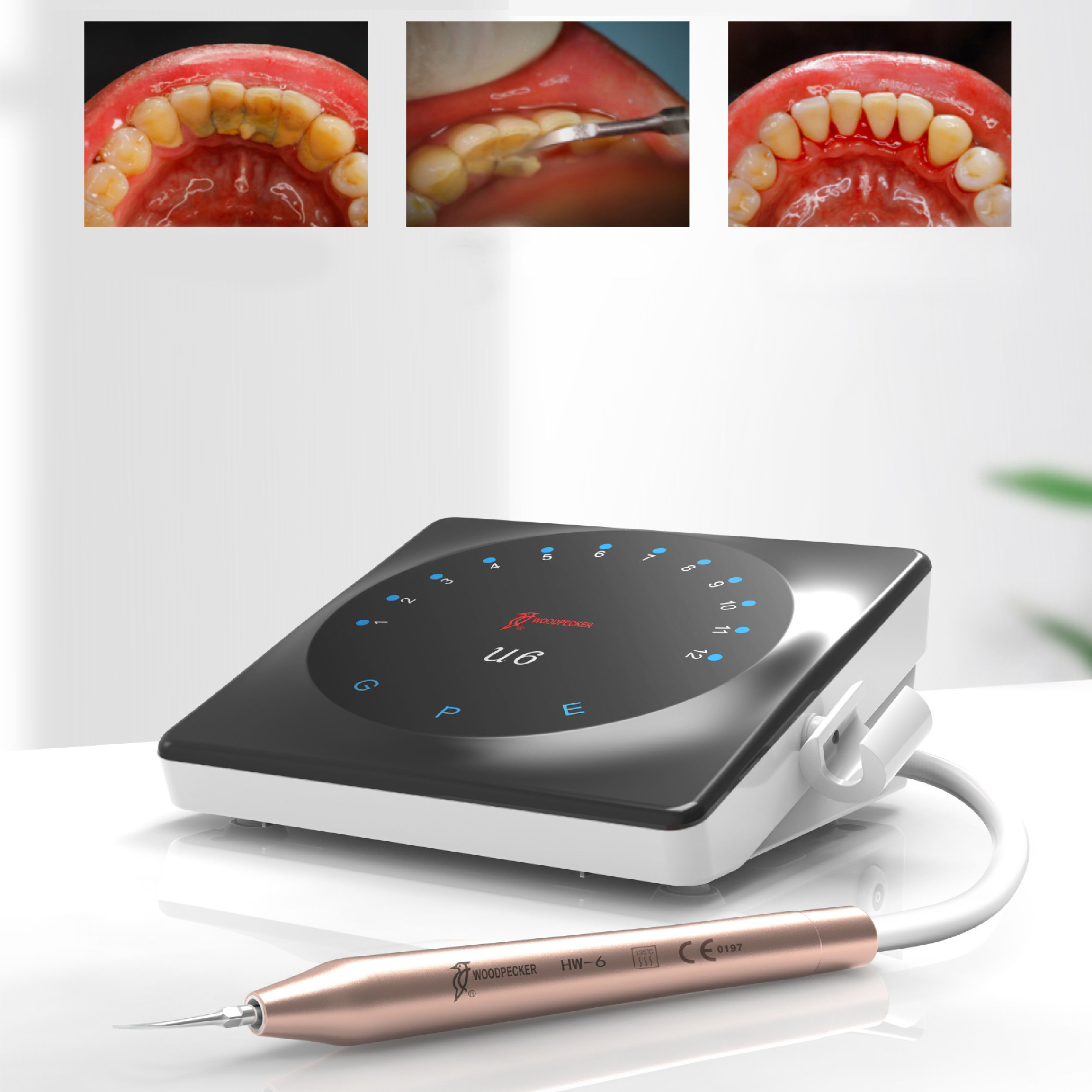 Máy cạo vôi Ultrasonic U6 Led Woodpecker - Máy lấy cao