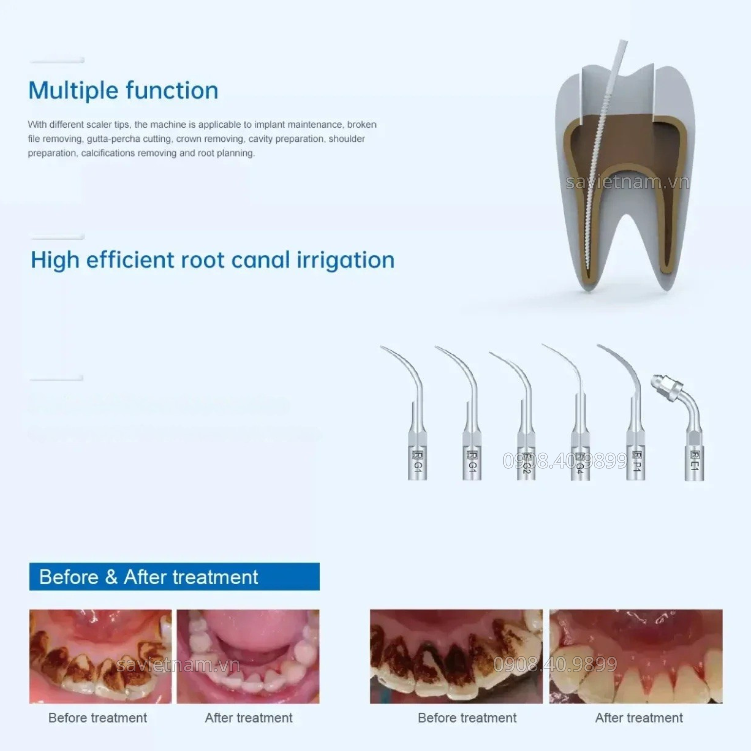 Máy lấy cao răng siêu âm Refine Max Piezo 6+