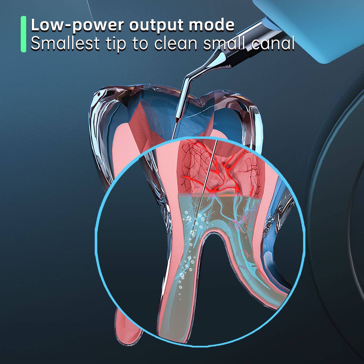 Máy Rung Rửa Nội Nha COXO Ultra Smart AI