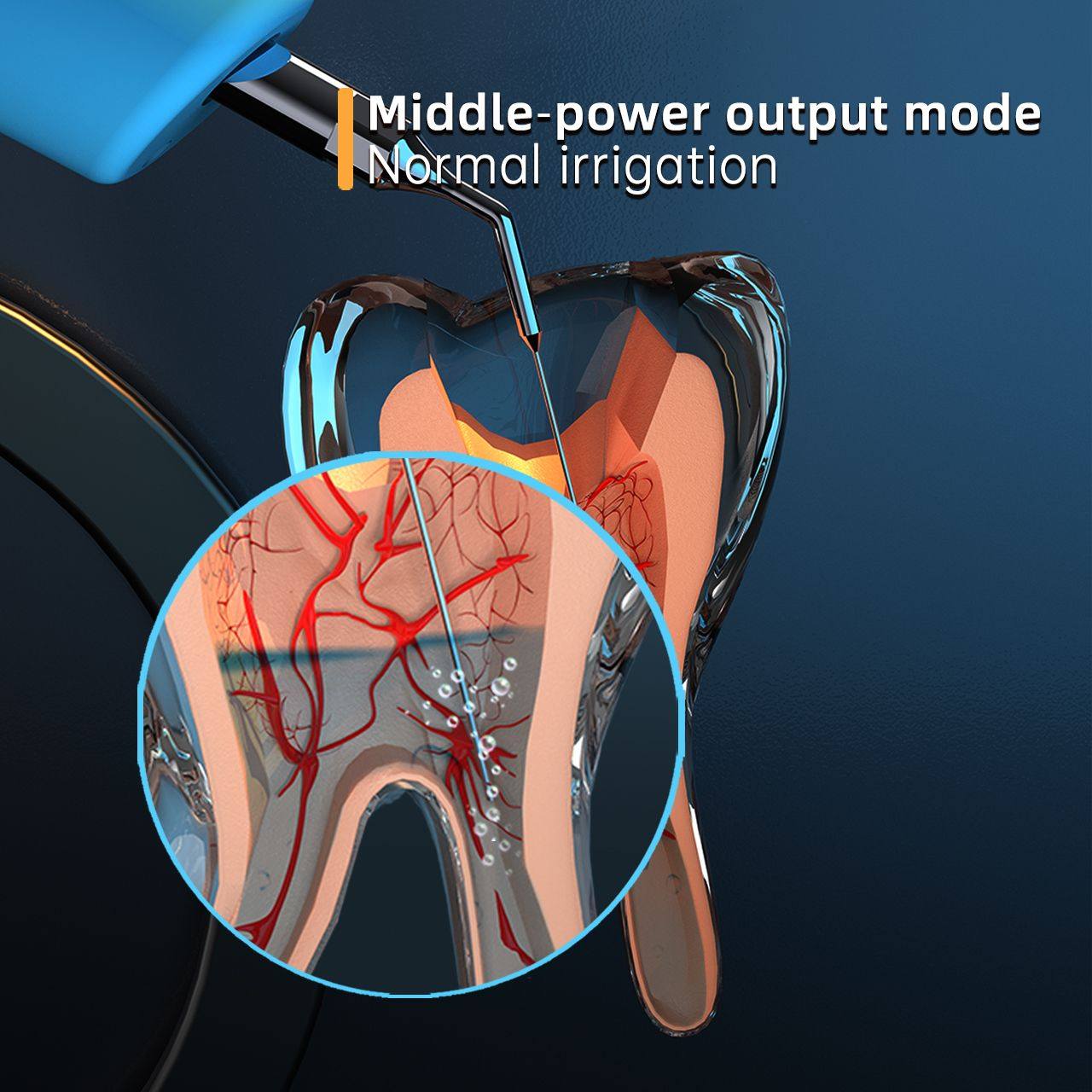 Máy Rung Rửa Nội Nha COXO Ultra Smart AI