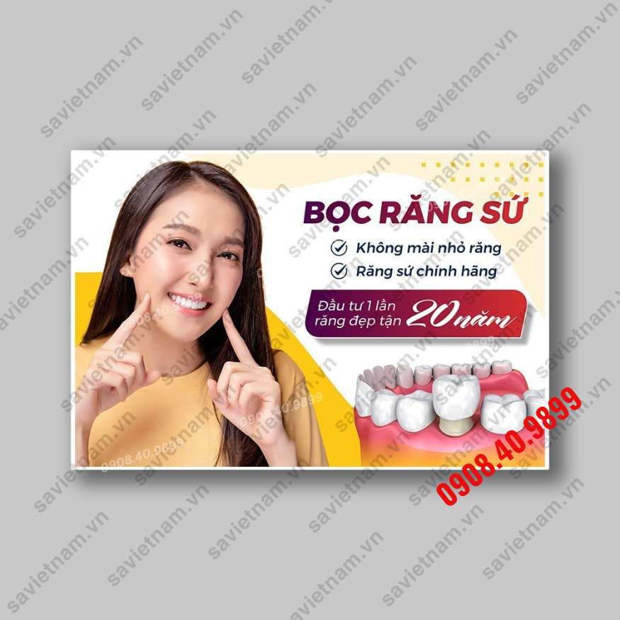 Tranh Răng sứ thẩm mỹ