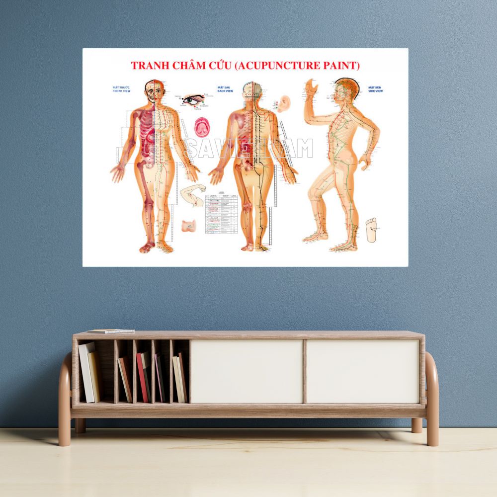 Tranh châm cứu