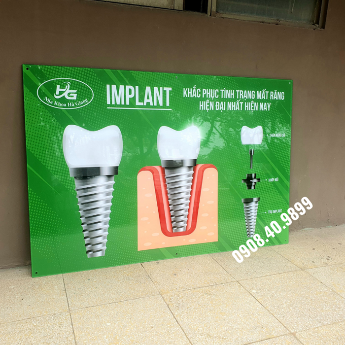 Tranh implant nha khoa