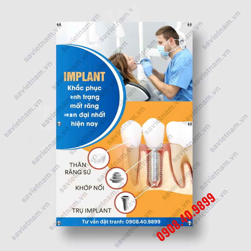 tranh implant nha khoa