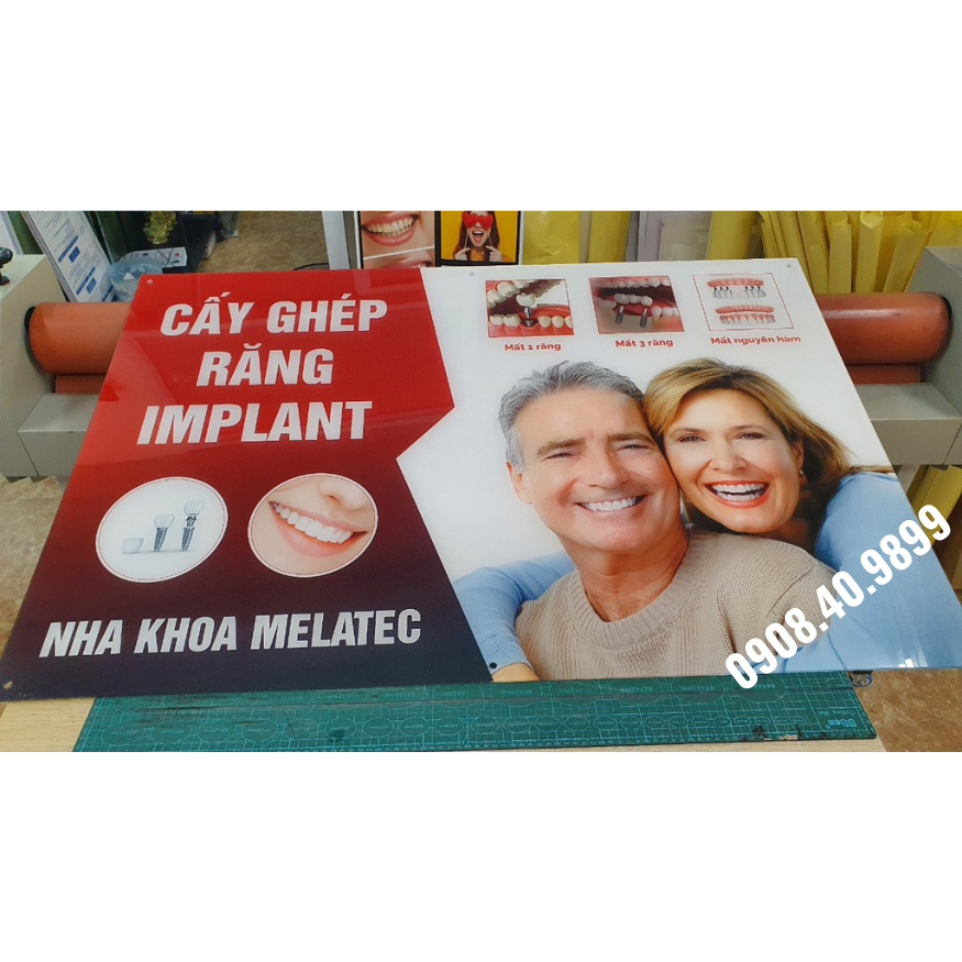 Tranh Cấy ghép implant nha khoa