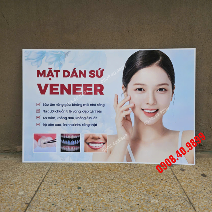 Tranh Mặt dán sứ Veneer