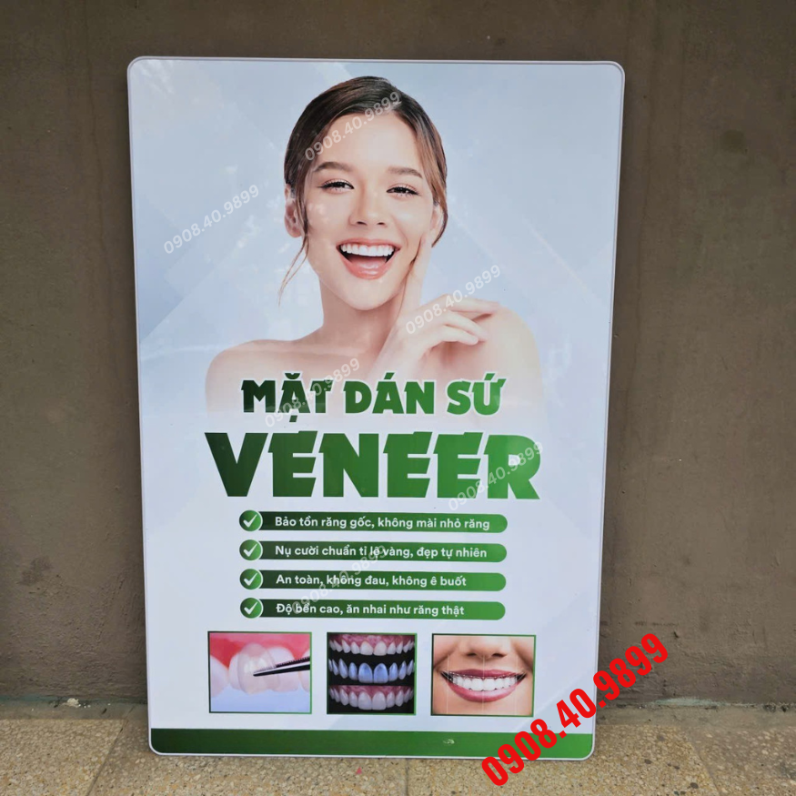 Tranh Mặt dán sứ Veneer