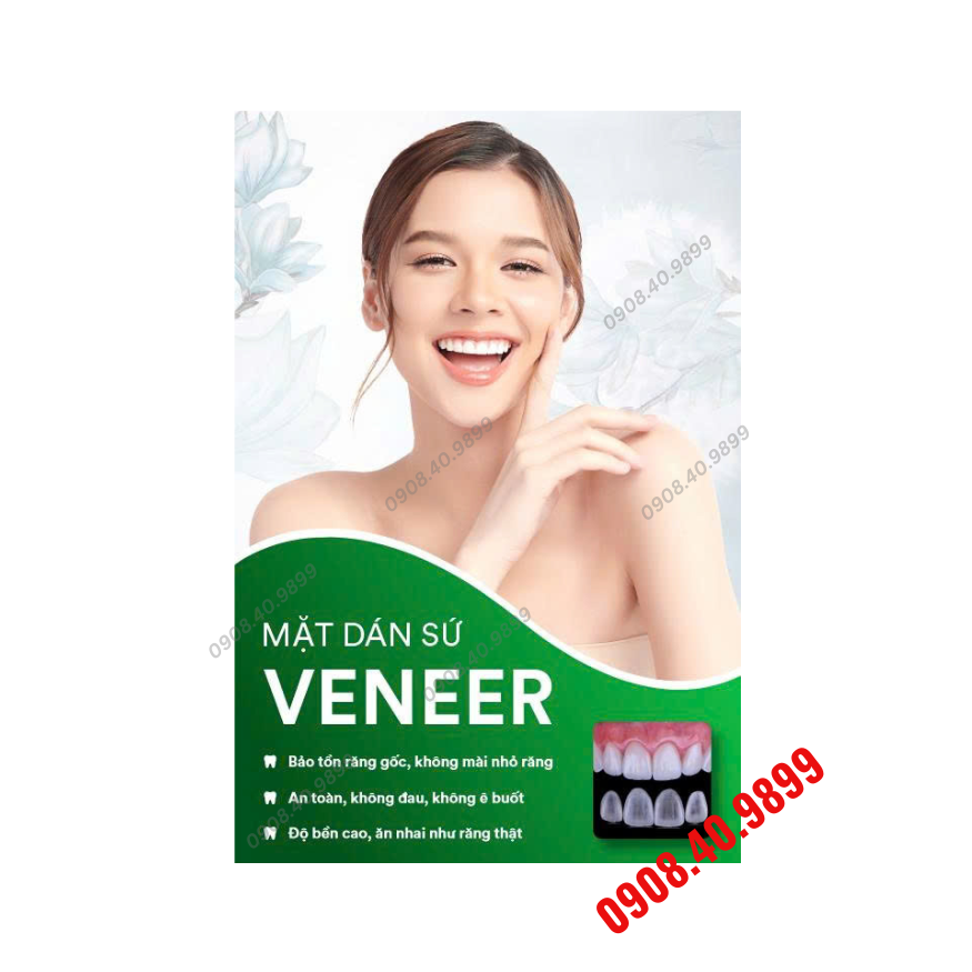Tranh Mặt dán sứ Veneer