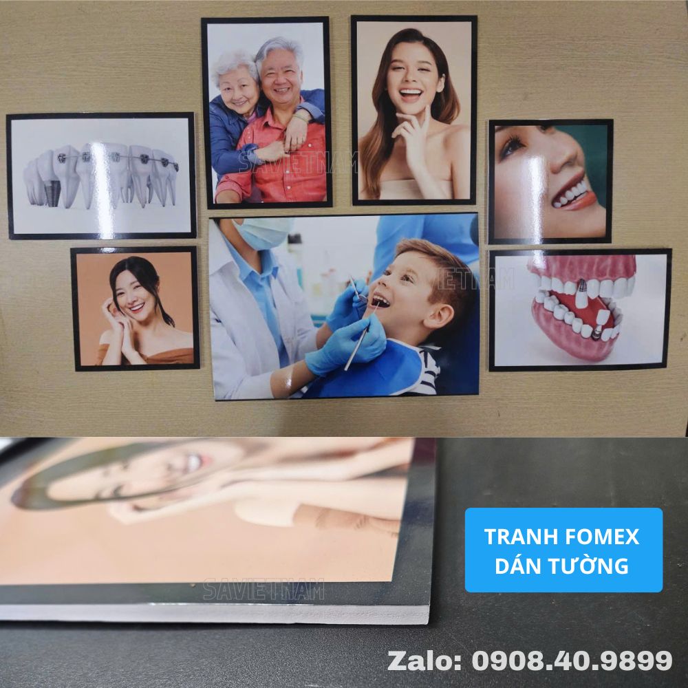 tranh nha khoa, set tranh nha khoa fomex